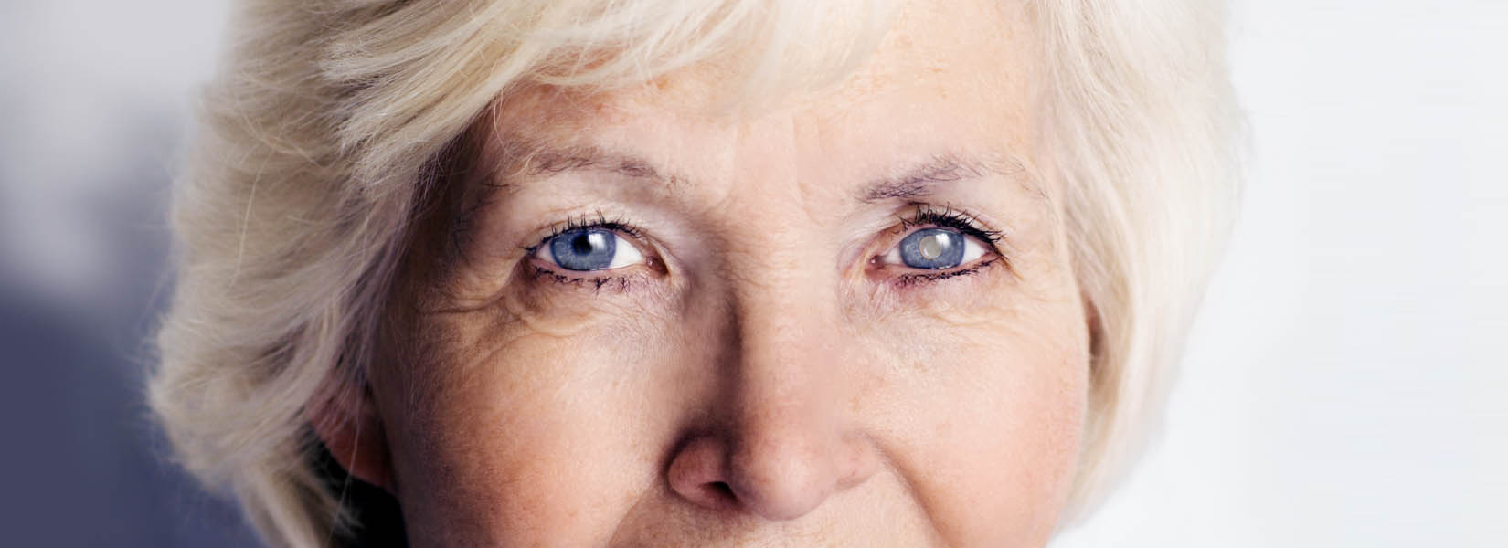 Cataract Surgery in Hannibal